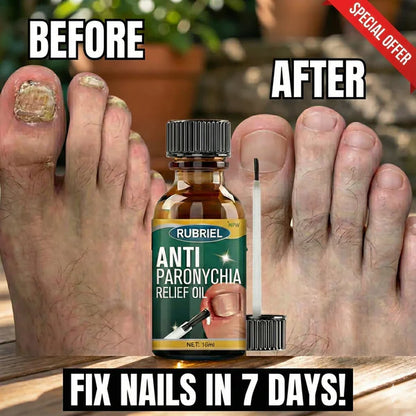 Anti Paronychia Relief Oil (Buy1 Get1  FREE)