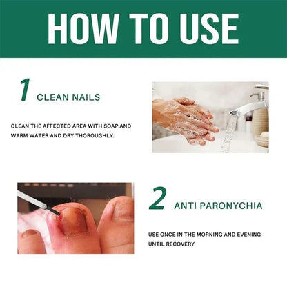 Anti Paronychia Relief Oil (Buy1 Get1  FREE)